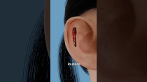 Thumbnail for How Ear Pinning Works 🤔 | Zack D. Films