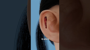Thumbnail for How Ear Pinning Works 🤔 | Zack D. Films