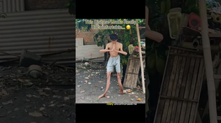 Thumbnail for This Condition Looks Extremely Painful… 😔 #interesting | IdkSterling