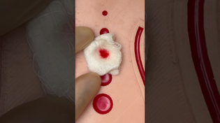 Thumbnail for Gunshot Wound First Aid ⛑️ #emergency #goodtoknow #firstaid #vet #medicine #funfacts #surgeonlife | Vetventures