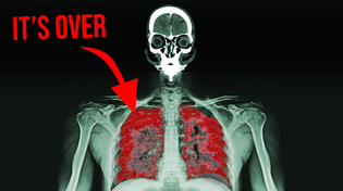 Thumbnail for "It smelled funny while I was welding and now I can't breathe..." | Chubbyemu